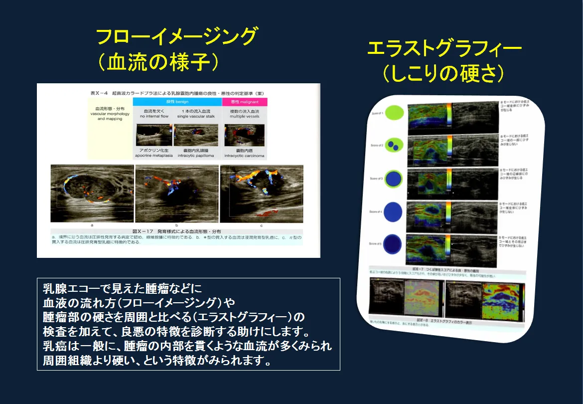 腫瘤の良悪判定をするためには？