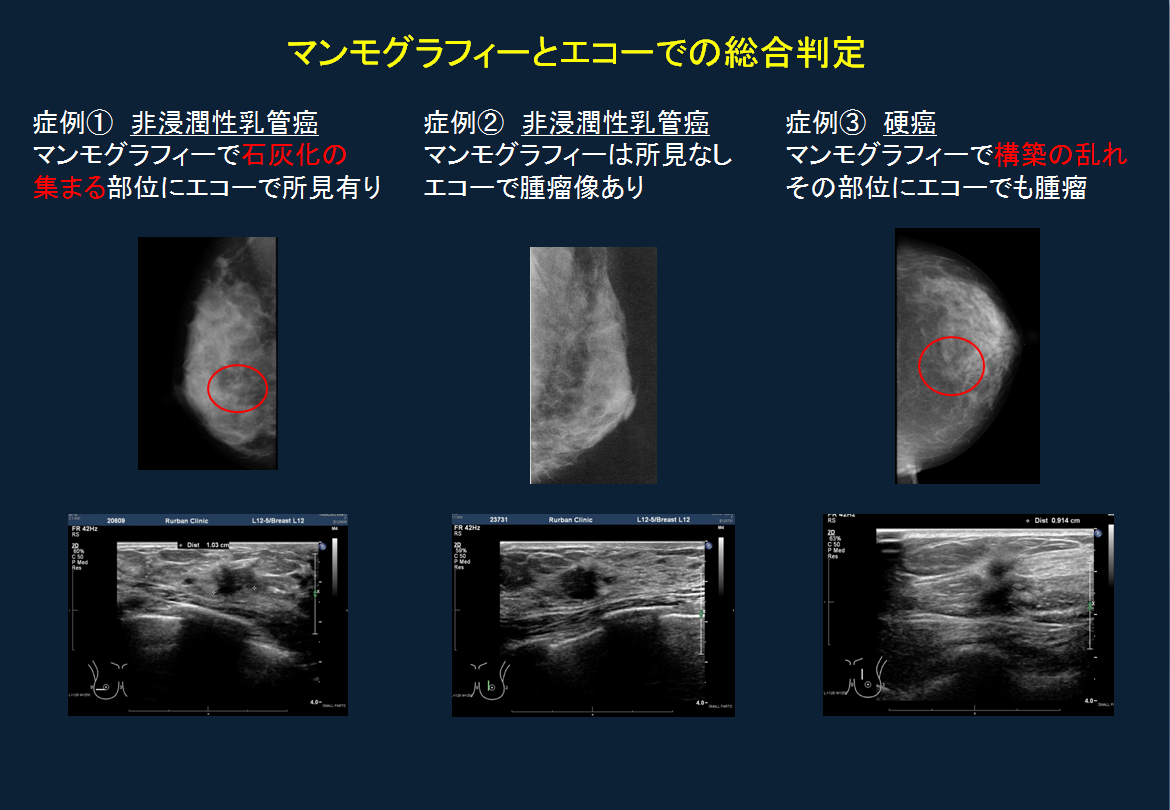 石灰化とは？