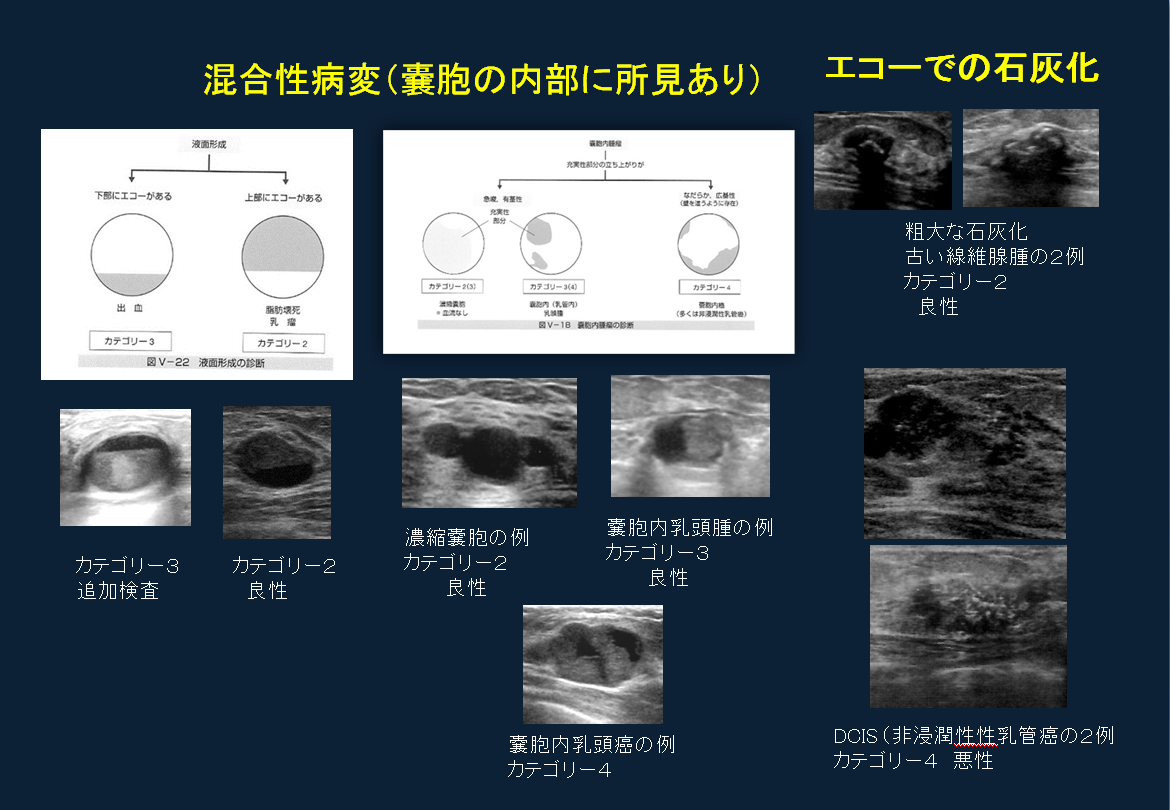 石灰化とは？